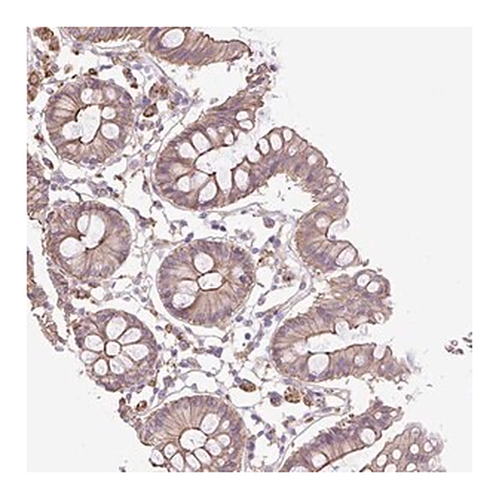 Merck Anti-OR13D1 antibody produced in rabbit