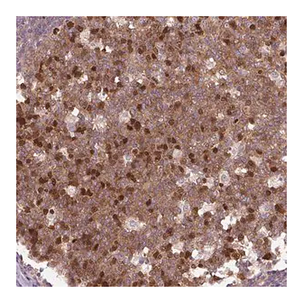 Merck Anti-KIFC1 antibody produced in rabbit