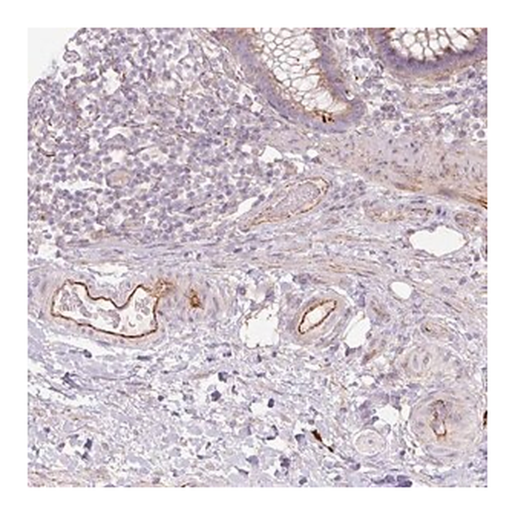 Merck Anti-CCNI2 antibody produced in rabbit