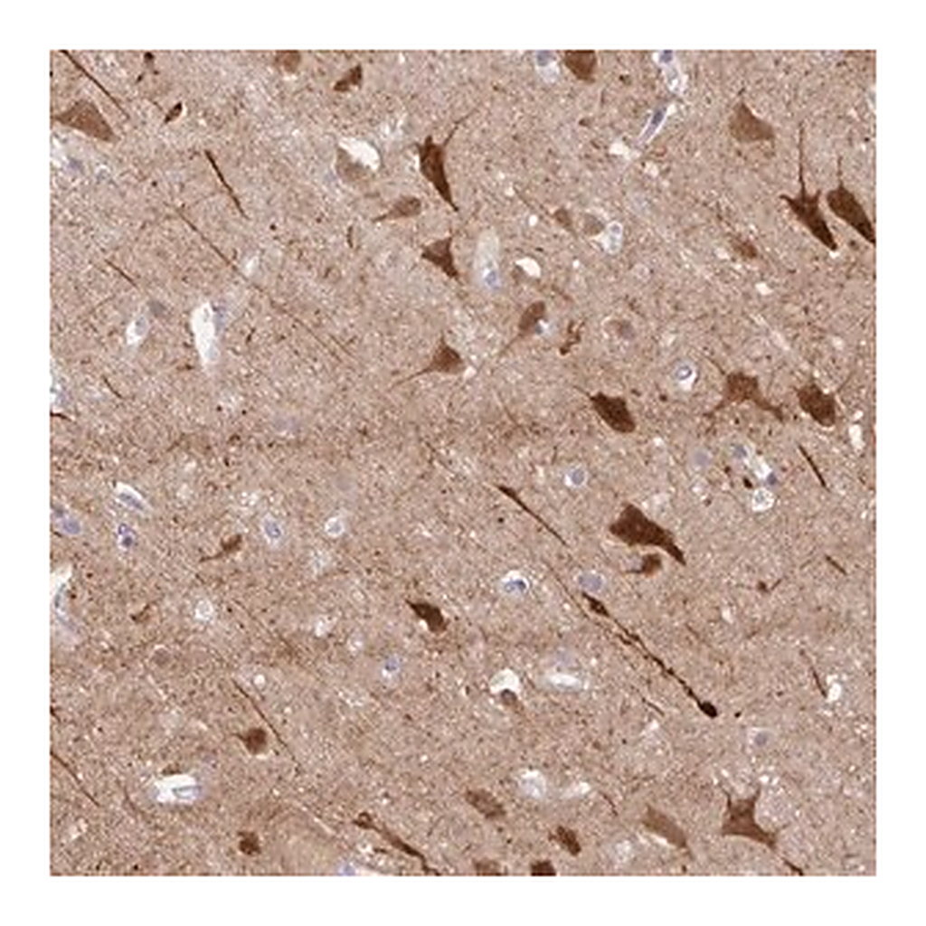 Merck Anti-OR4N4 antibody produced in rabbit