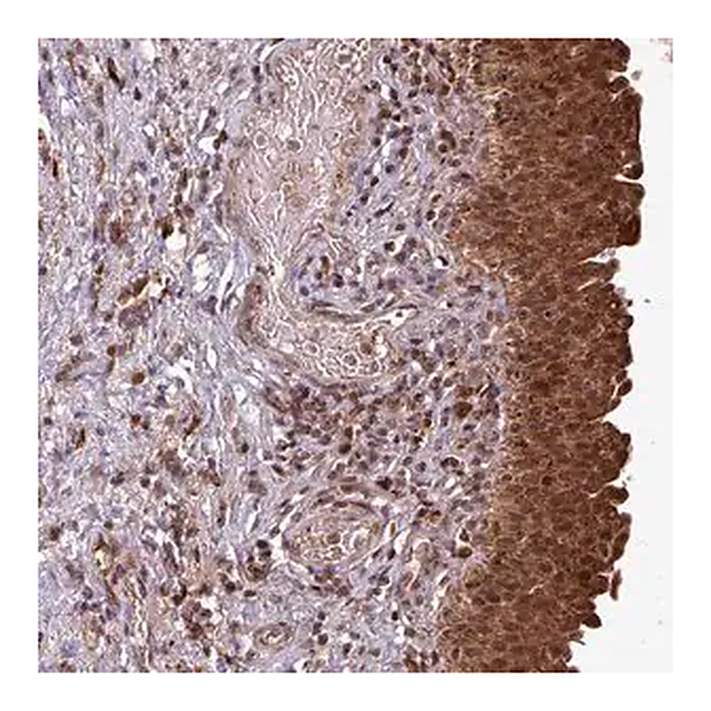 Merck Anti-OR6B1 antibody produced in rabbit