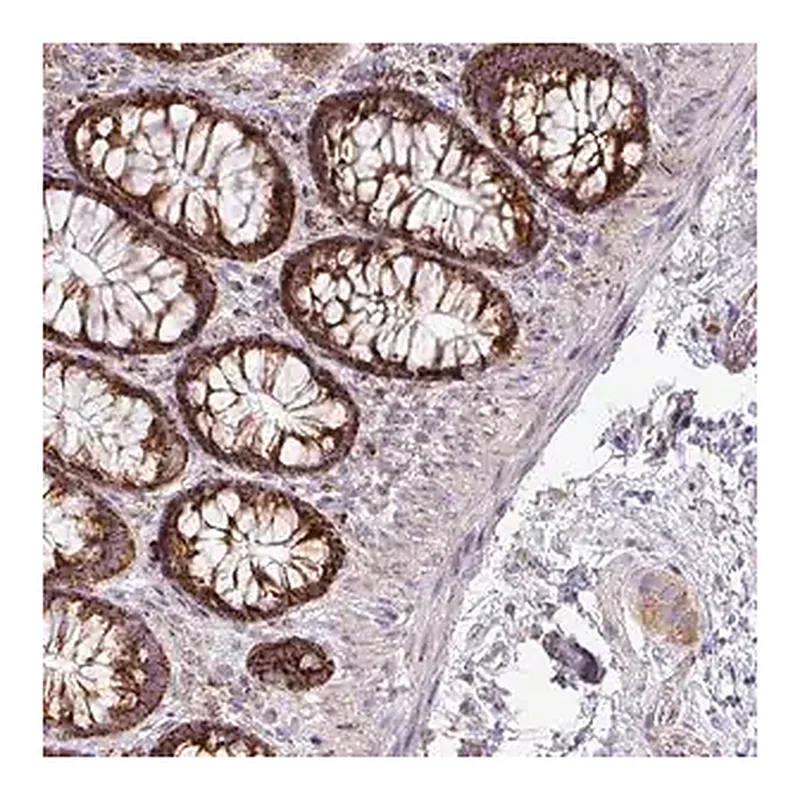 Merck Anti-ZNF81 antibody produced in rabbit