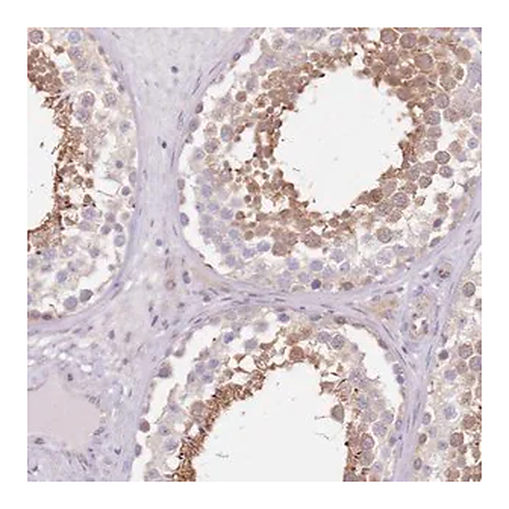 Merck Anti-TBC1D9 antibody produced in rabbit