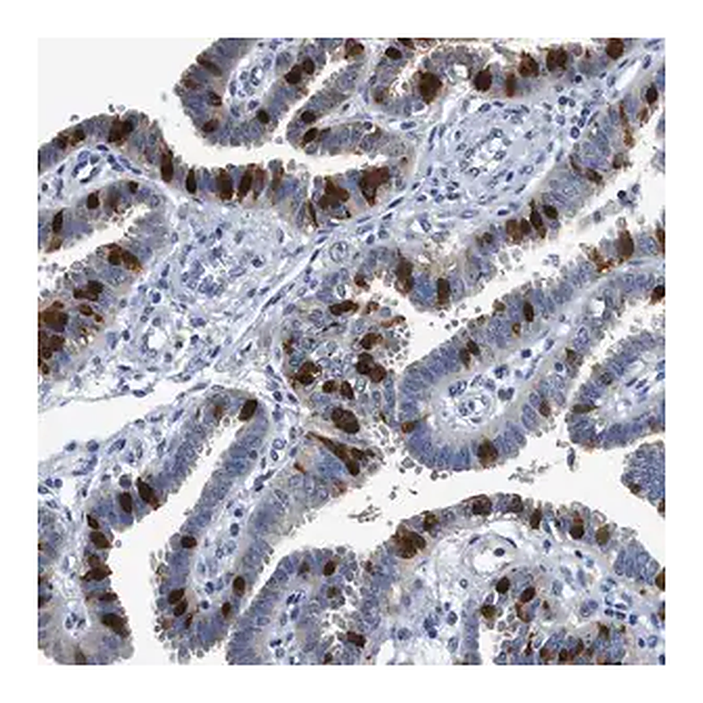 Merck Anti-FADS6 antibody produced in rabbit