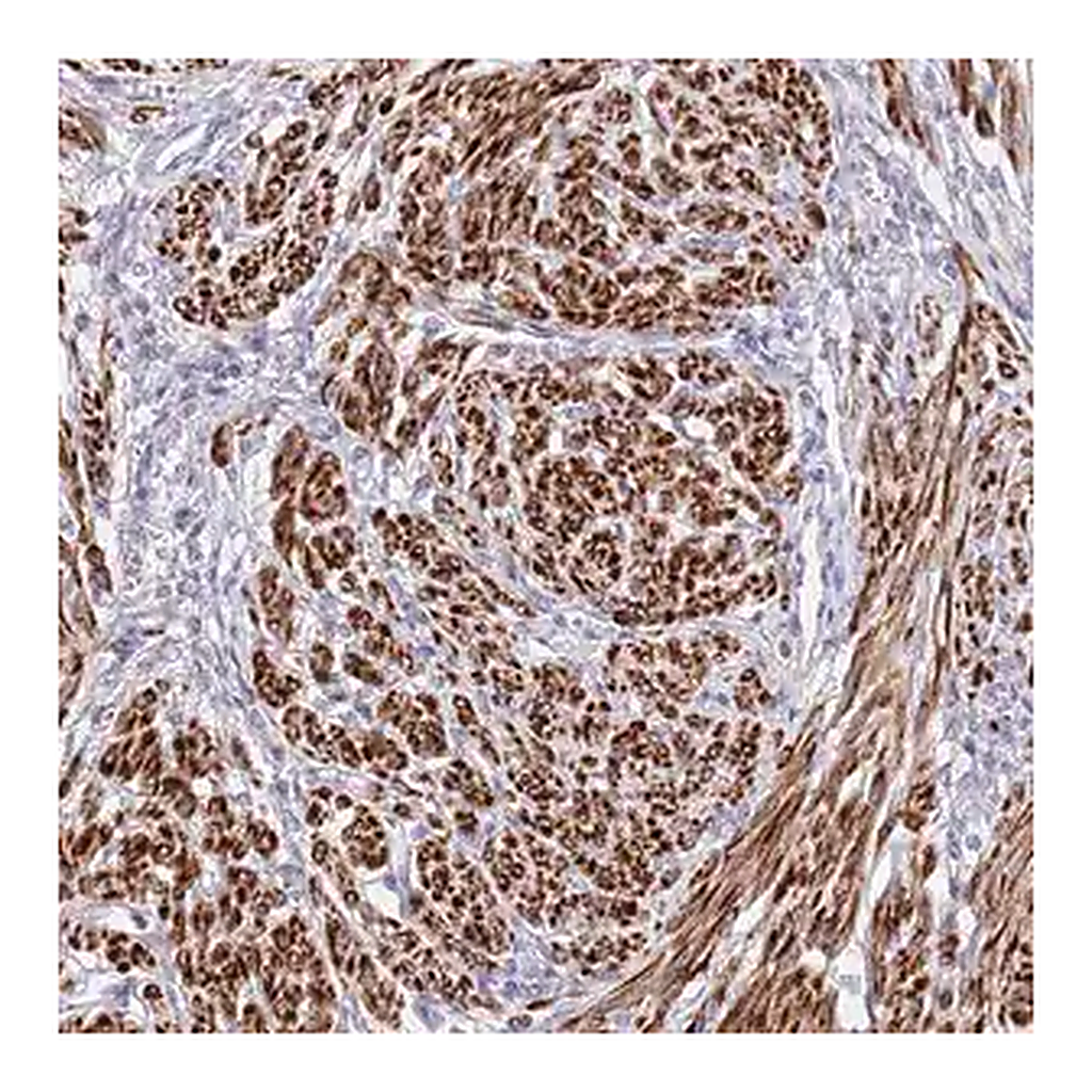 Merck Anti-NET1 antibody produced in rabbit