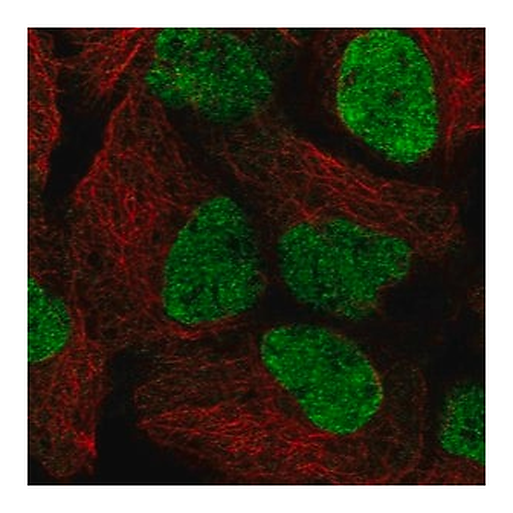 Merck Anti-SMARCAL1 antibody produced in rabbit