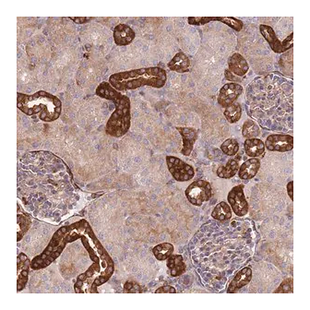 Merck Anti-ZMYM5 antibody produced in rabbit