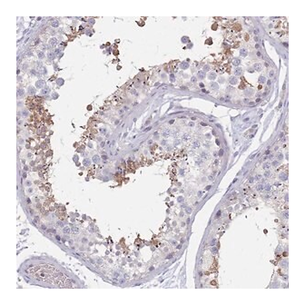 Merck Anti-RAB11FIP4 antibody produced in rabbit