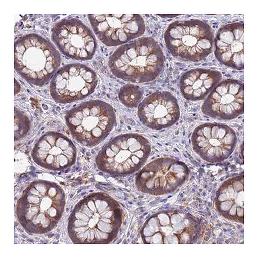 Merck Anti-TTLL11 antibody produced in rabbit