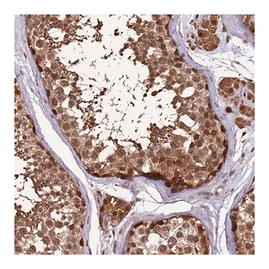 Merck Anti-ZBTB5 antibody produced in rabbit