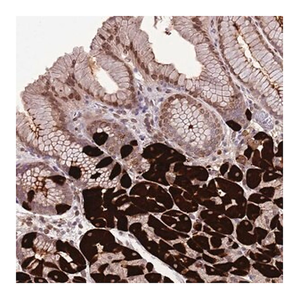 Merck Anti-ZNF665 antibody produced in rabbit