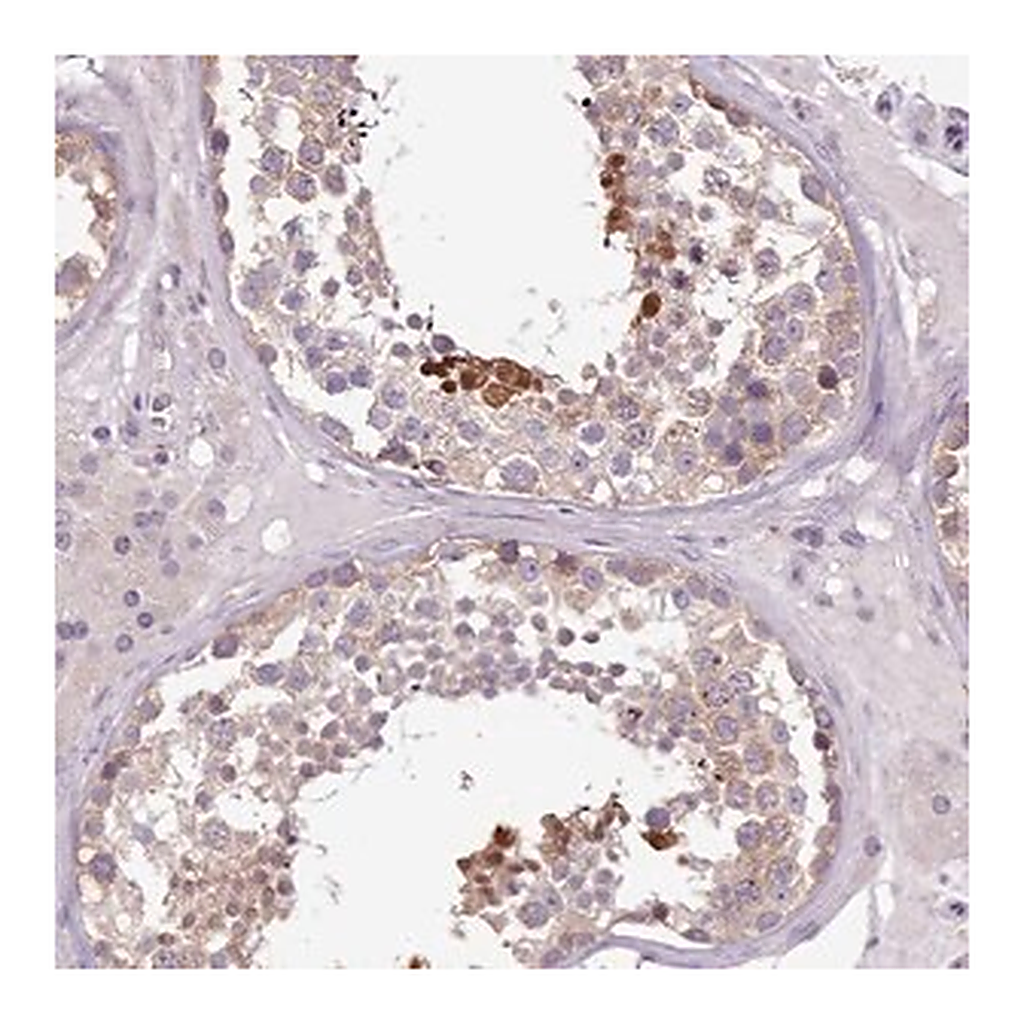 Merck Anti-SETX antibody produced in rabbit