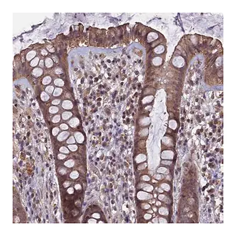 Merck Anti-HUNK antibody produced in rabbit