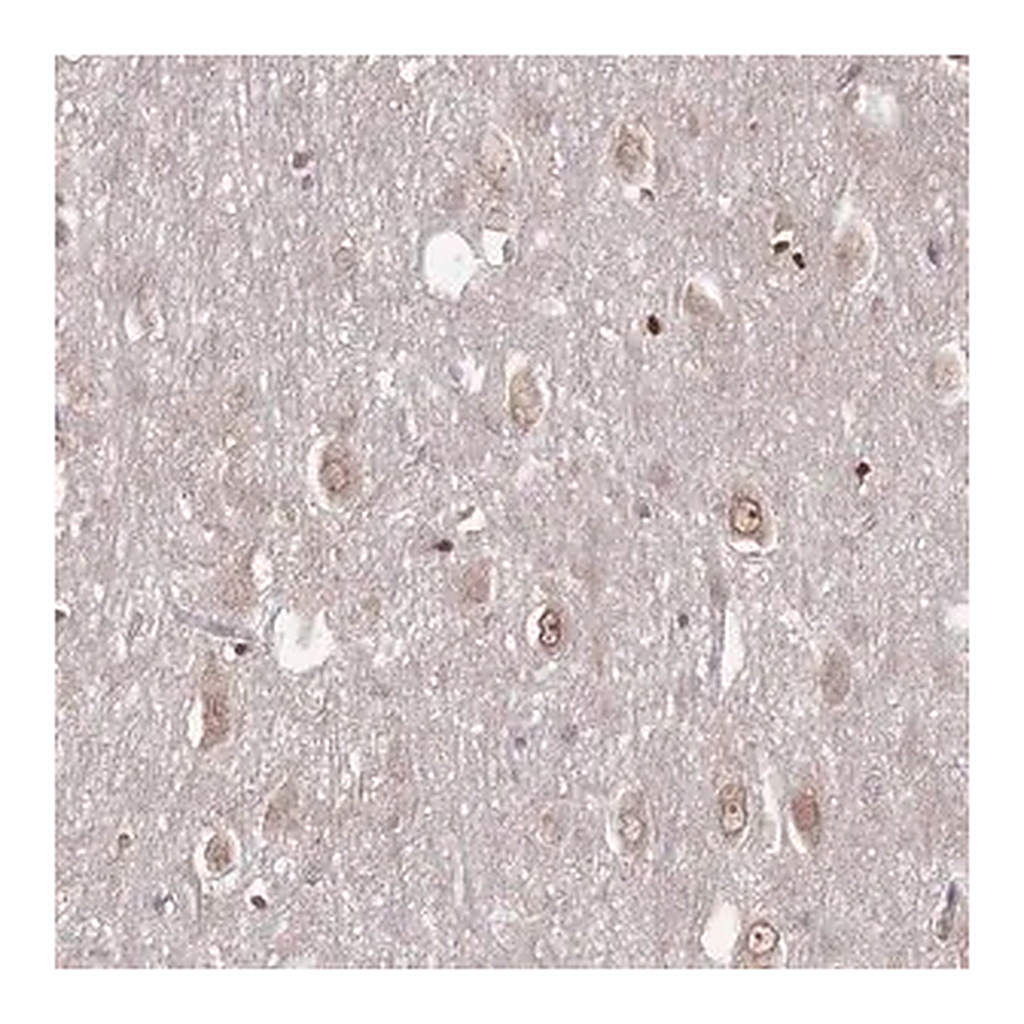 Merck Anti-TBC1D25 antibody produced in rabbit