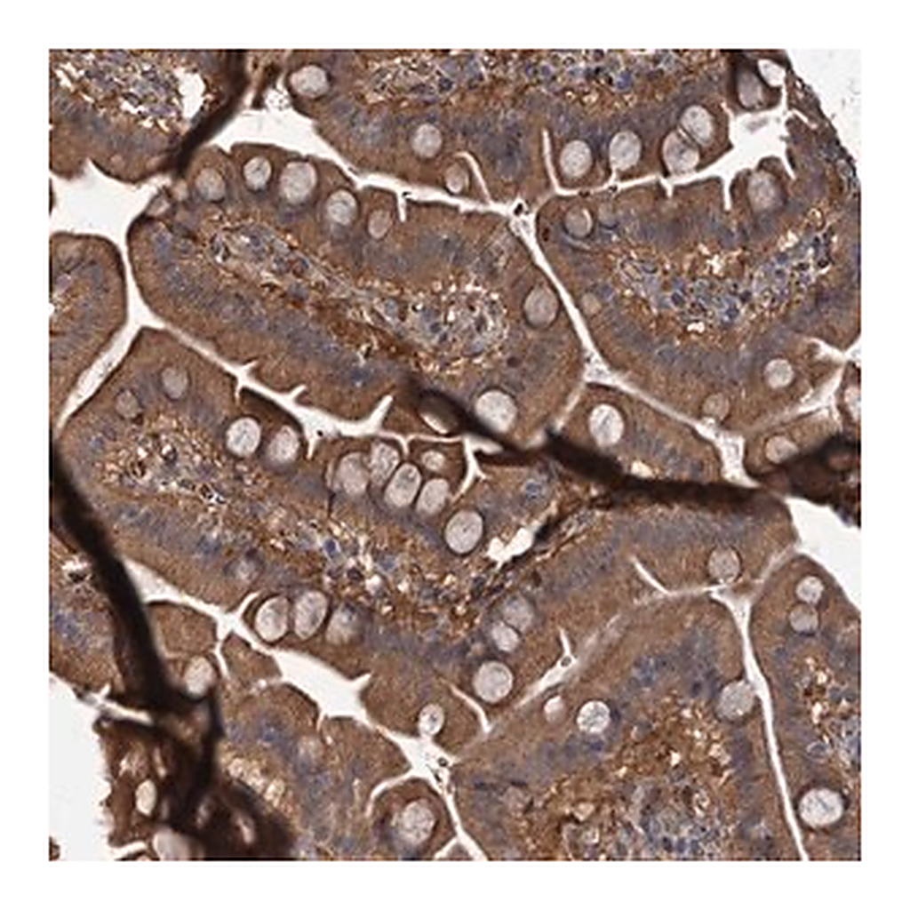 Merck Anti-PKN2 antibody produced in rabbit