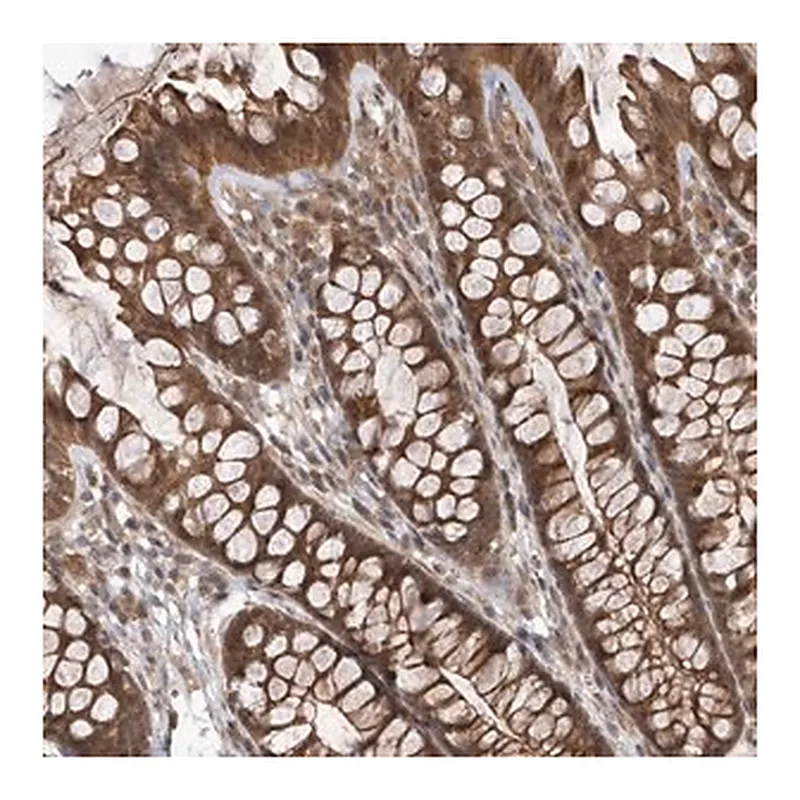 Merck Anti-GFM2 antibody produced in rabbit
