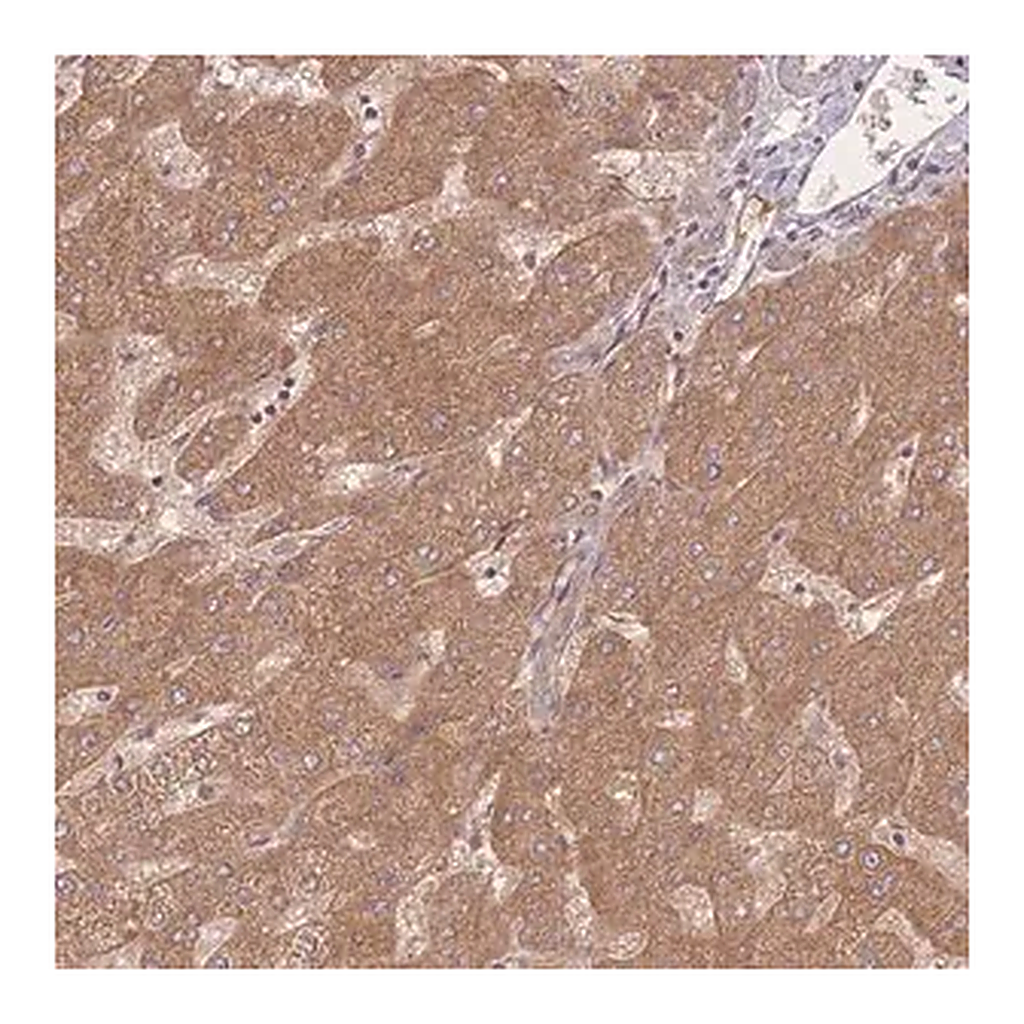 Merck Anti-INSR antibody produced in rabbit