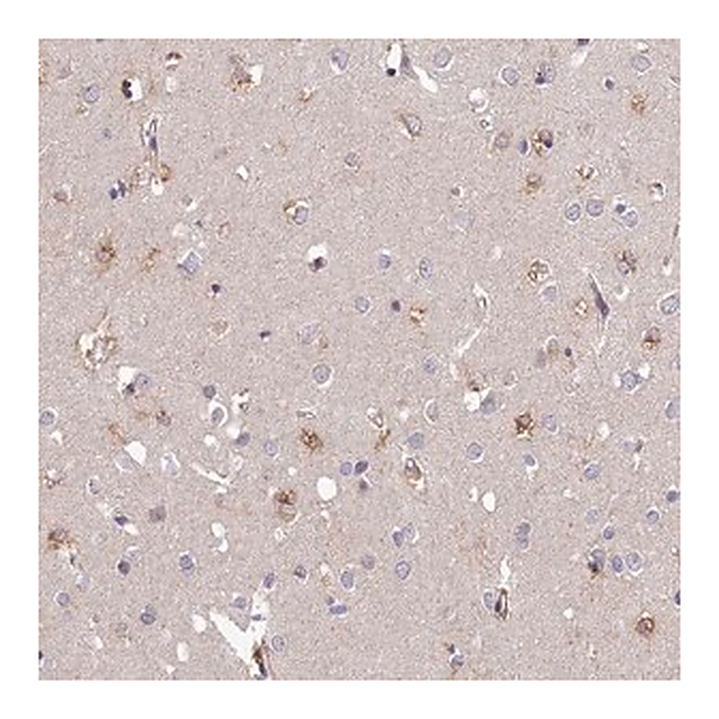 Merck Anti-ARL8A antibody produced in rabbit