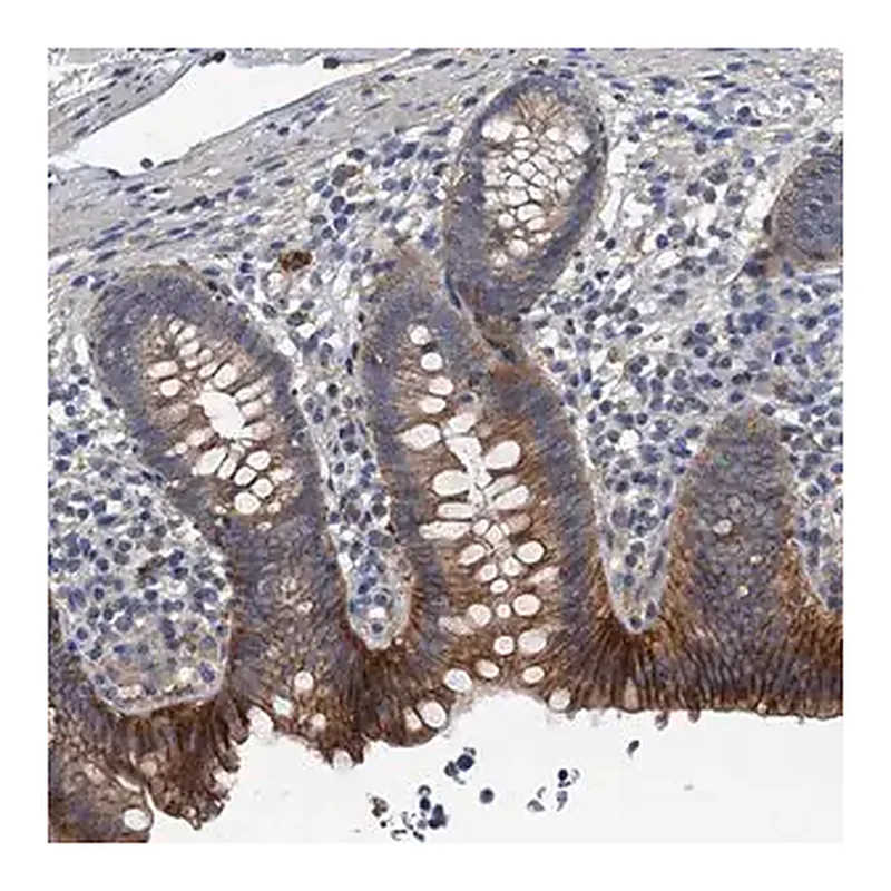 Merck Anti-SLC2A10 antibody produced in rabbit