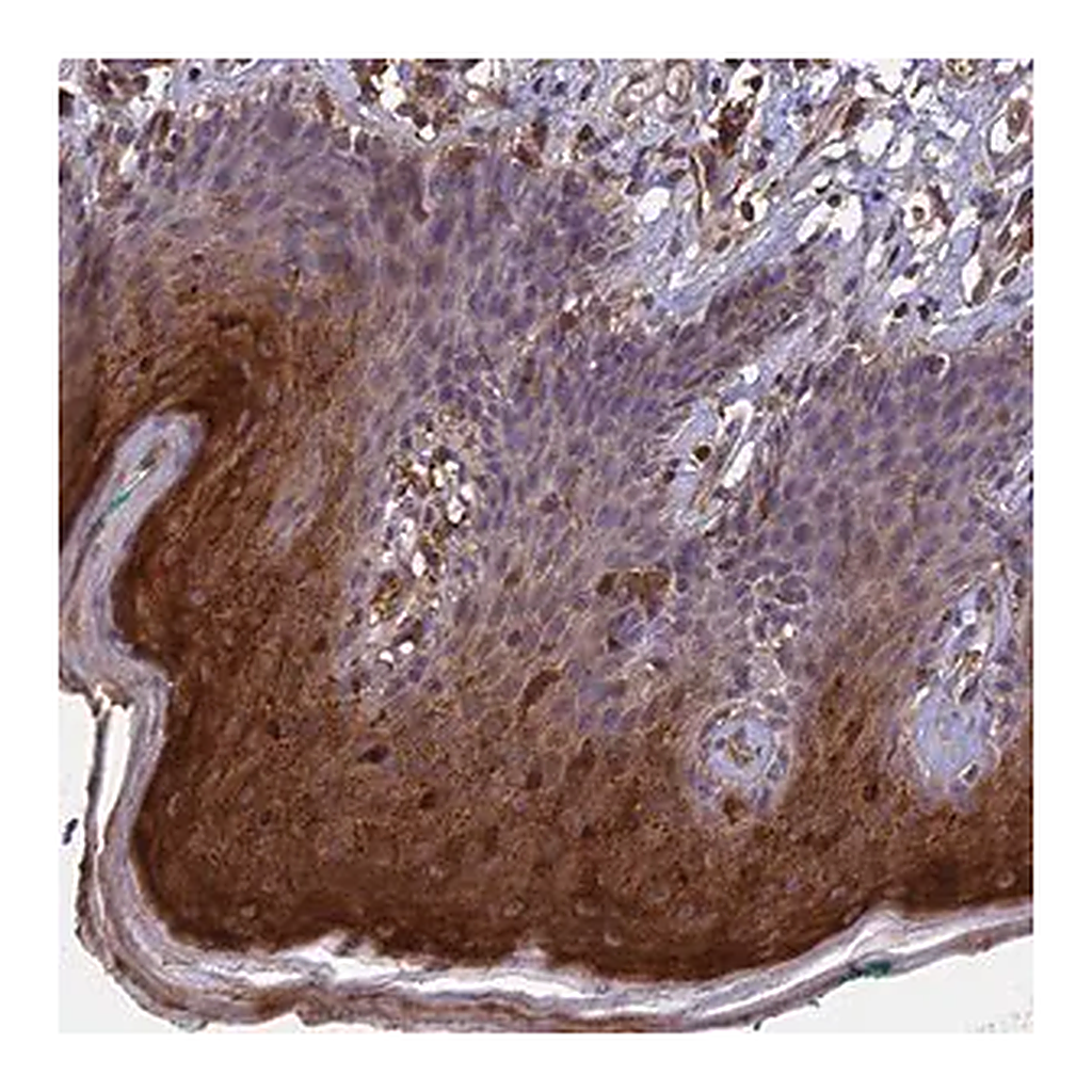Merck Anti-RASAL1 antibody produced in rabbit