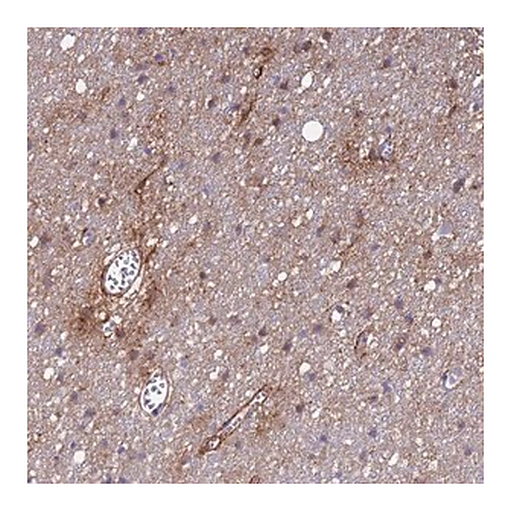 Merck Anti-P2RX7 antibody produced in rabbit
