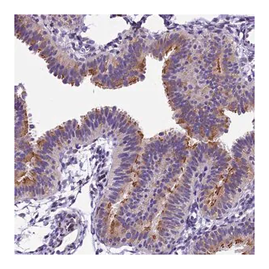Merck Anti-IFT140 antibody produced in rabbit
