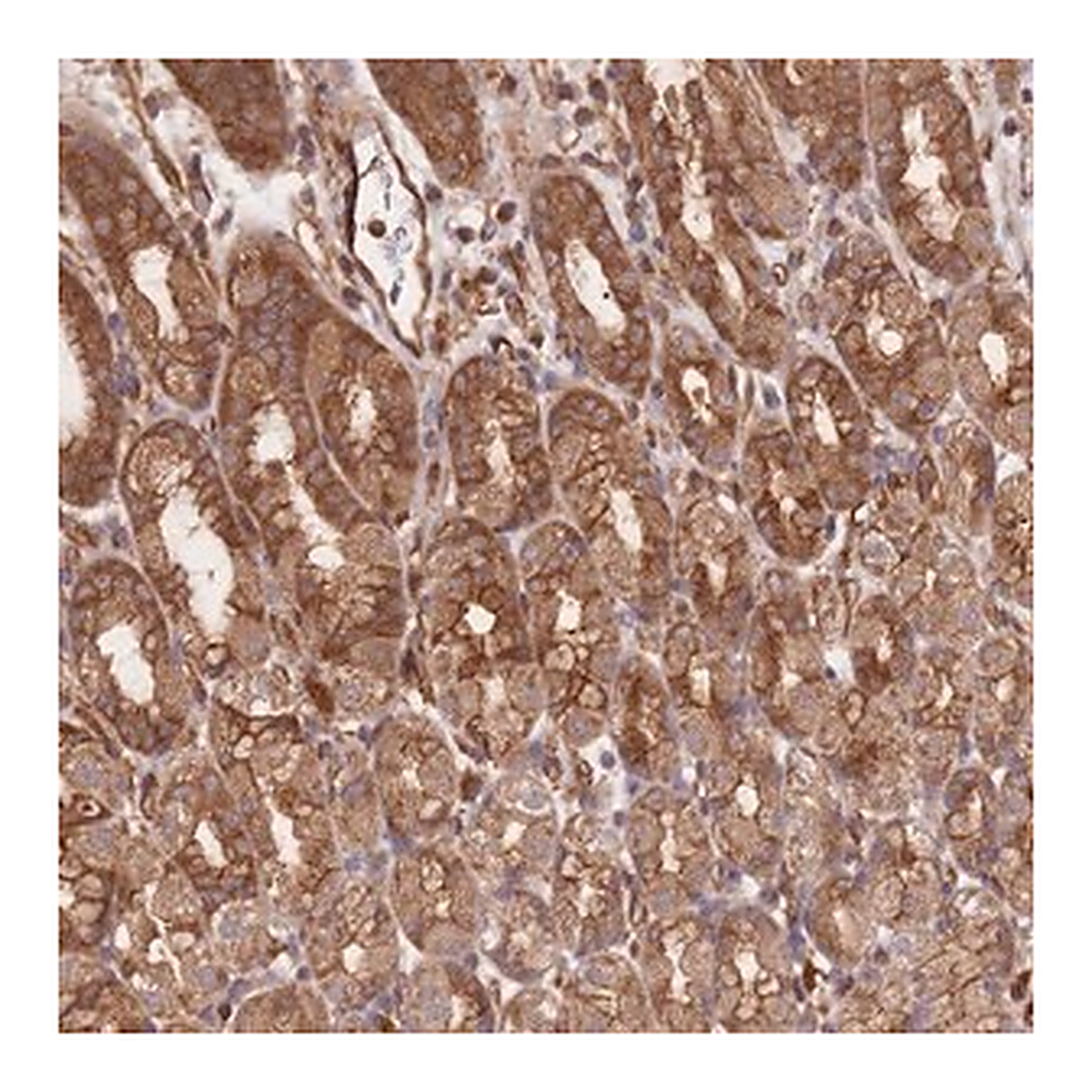 Merck Anti-CCDC140 antibody produced in rabbit