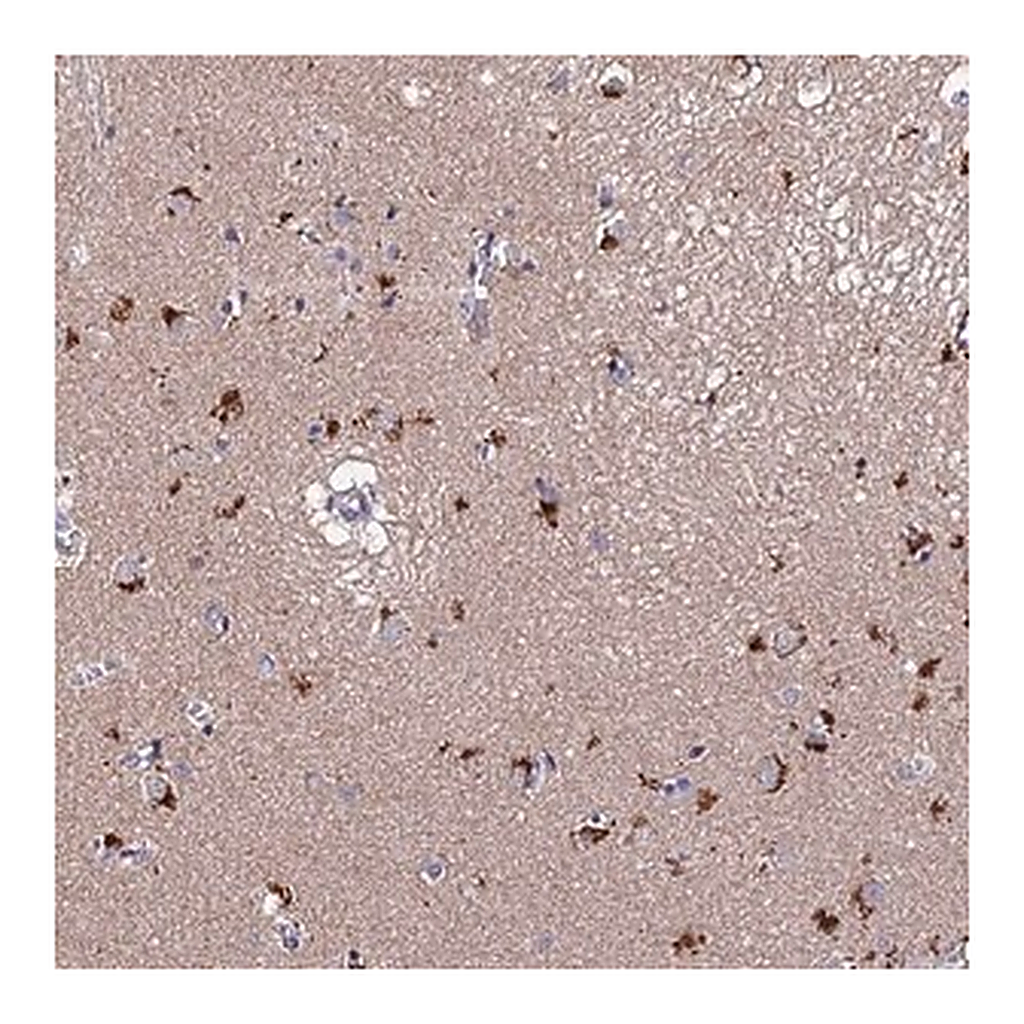 Merck Anti-ACTR5 antibody produced in rabbit