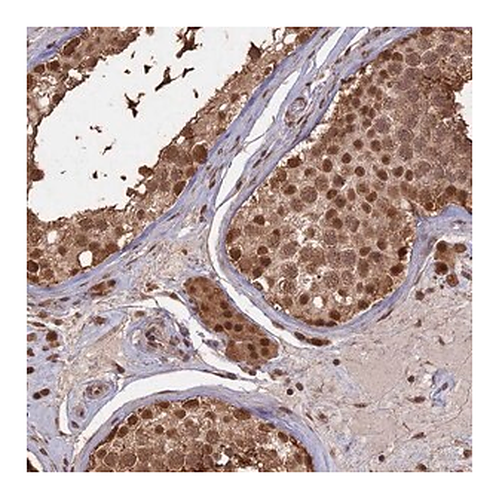 Merck Anti-PSMC6 antibody produced in rabbit