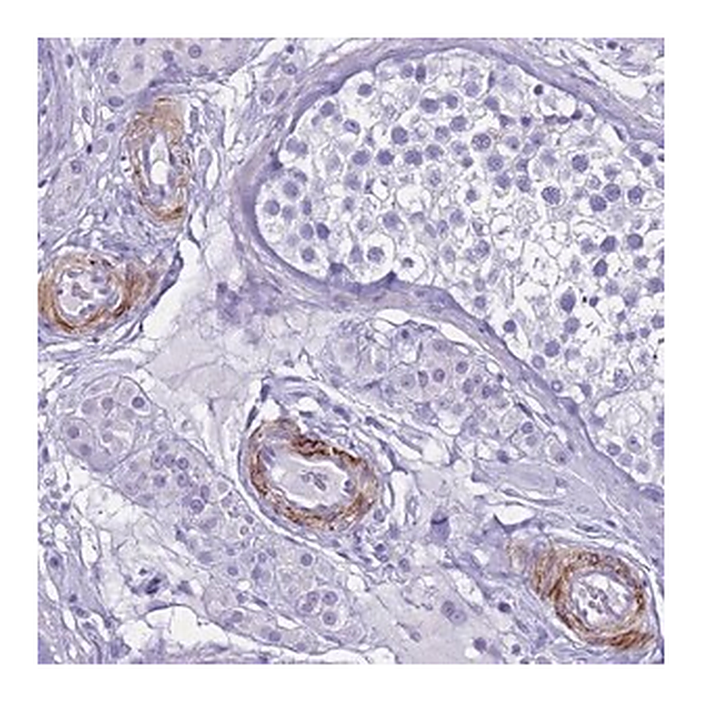 Merck Anti-LCMT1 antibody produced in rabbit