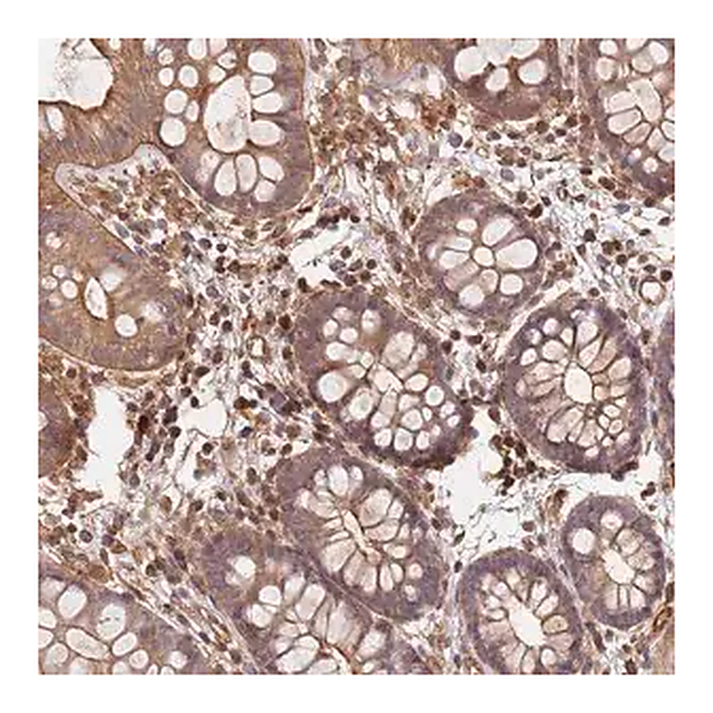 Merck Anti-SDCCAG8 antibody produced in rabbit