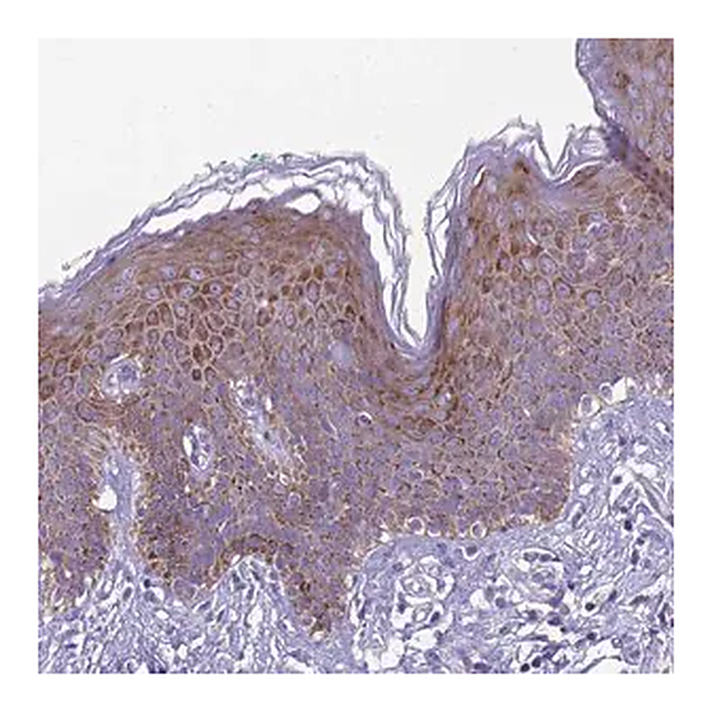 Merck Anti-TRIM51 antibody produced in rabbit