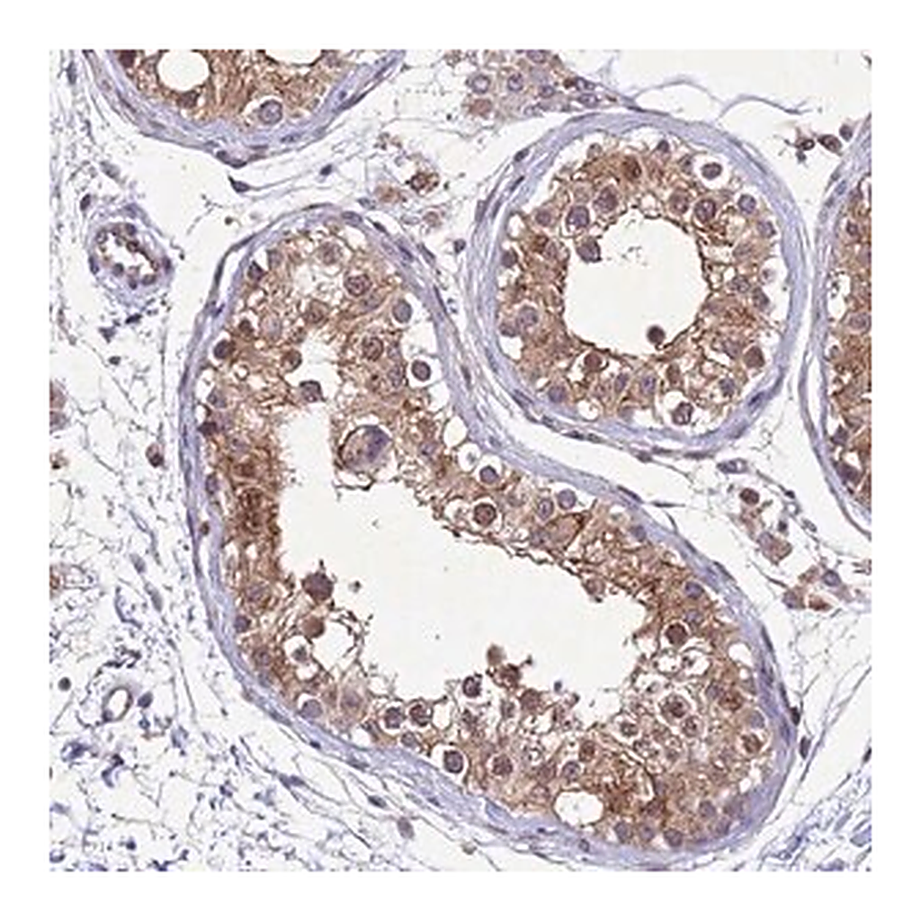 Merck Anti-TBK1 antibody produced in rabbit