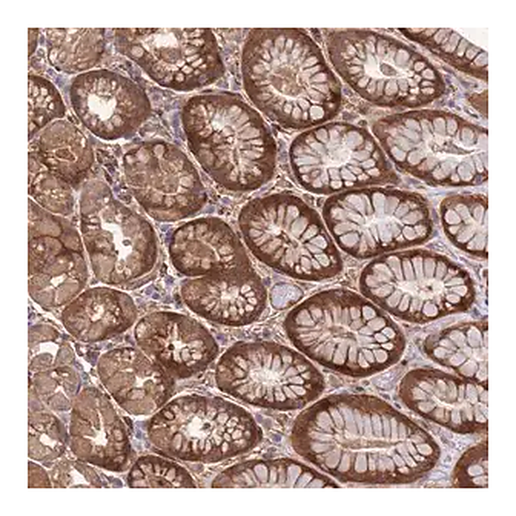 Merck Anti-FOXRED1 antibody produced in rabbit