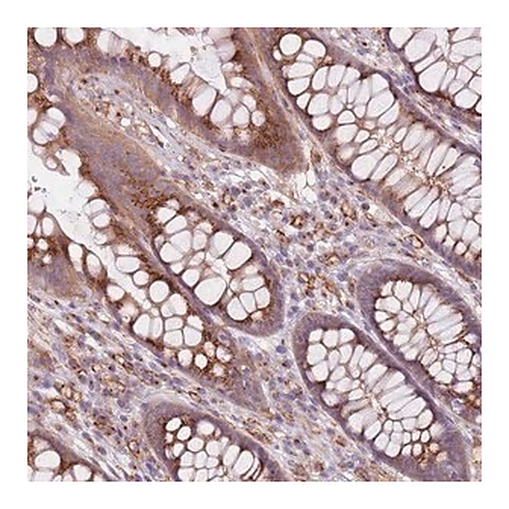 Merck Anti-AKTIP antibody produced in rabbit