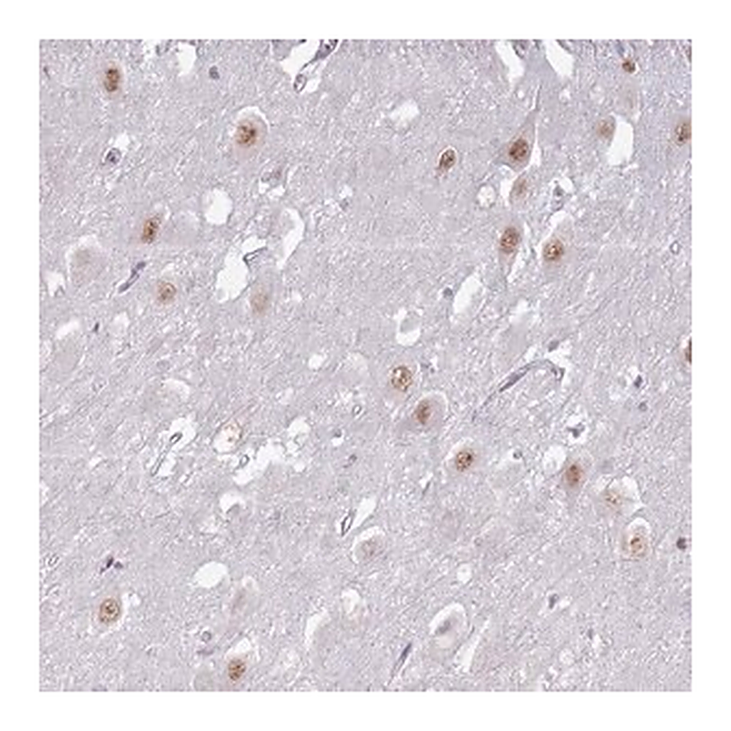 Merck Anti-PTCHD1 antibody produced in rabbit