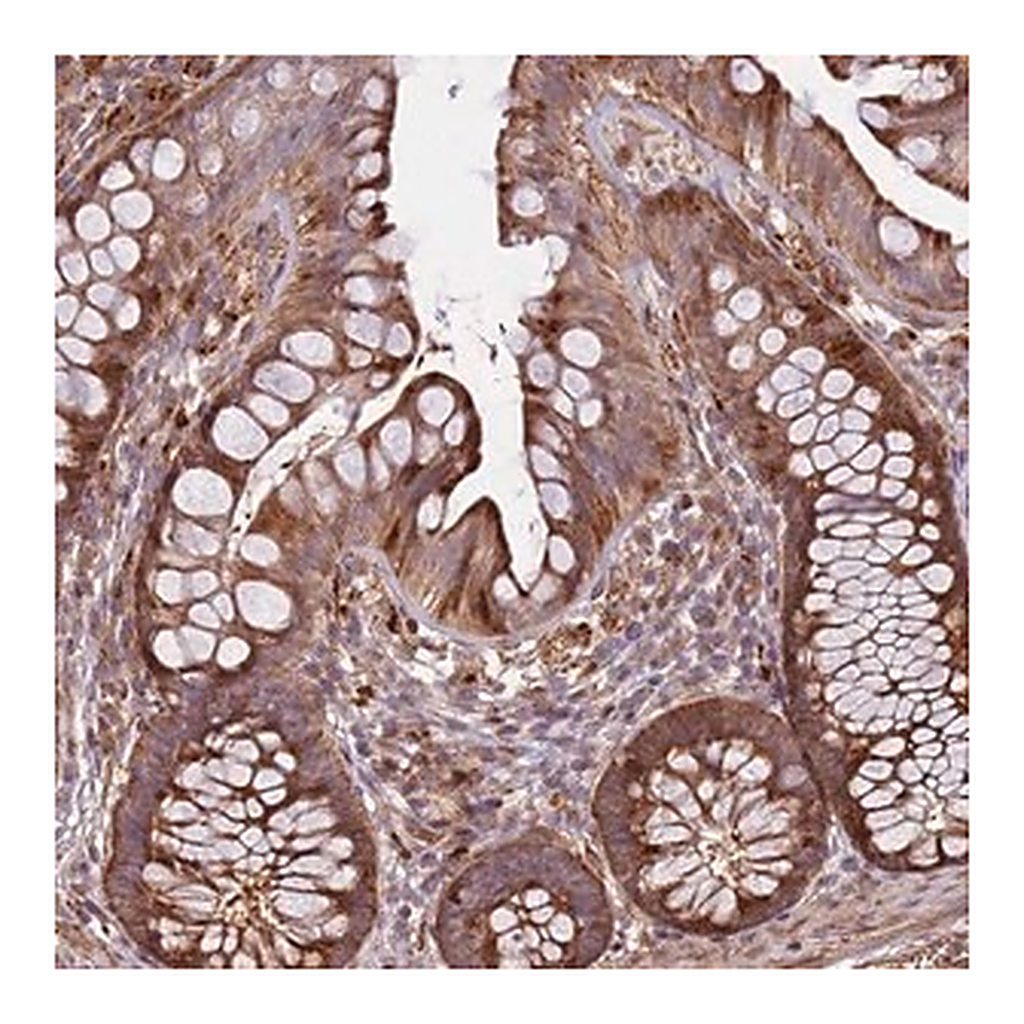 Merck Anti-RHBDL1 antibody produced in rabbit