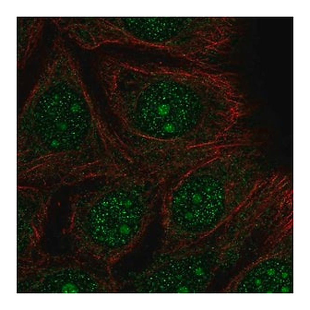 Merck Anti-DEGS2 antibody produced in rabbit