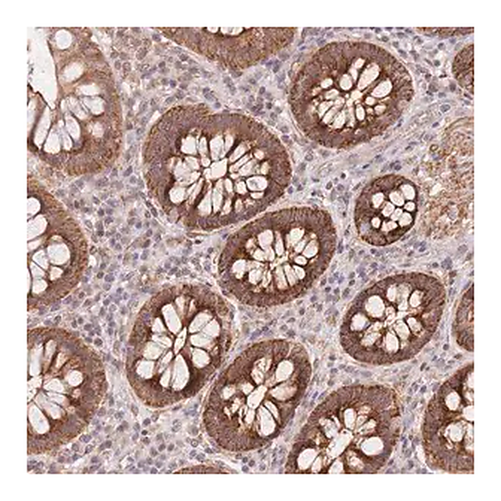 Merck Anti-UQCC3 antibody produced in rabbit