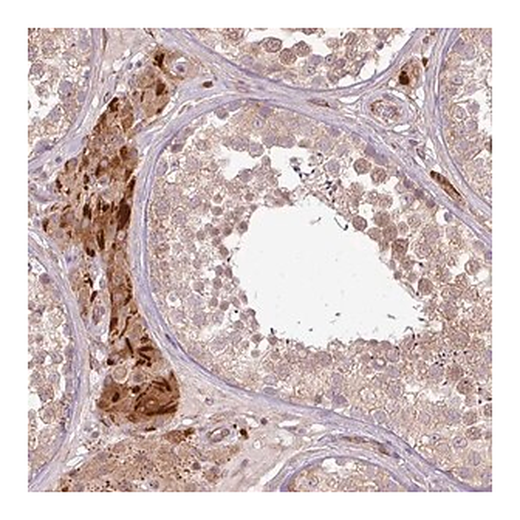 Merck Anti-PDRG1 antibody produced in rabbit