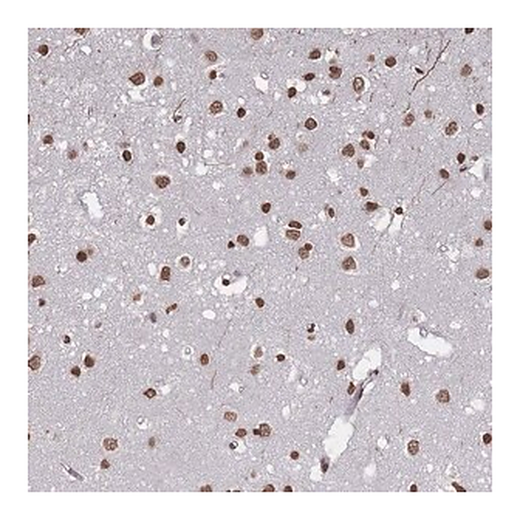 Merck Anti-PLEKHG5 antibody produced in rabbit