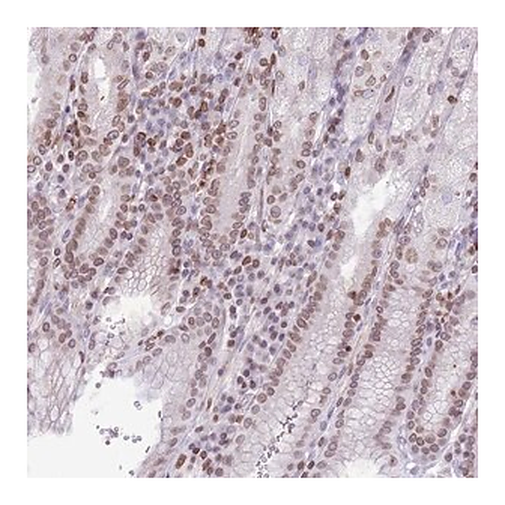 Merck Anti-RRNAD1 antibody produced in rabbit