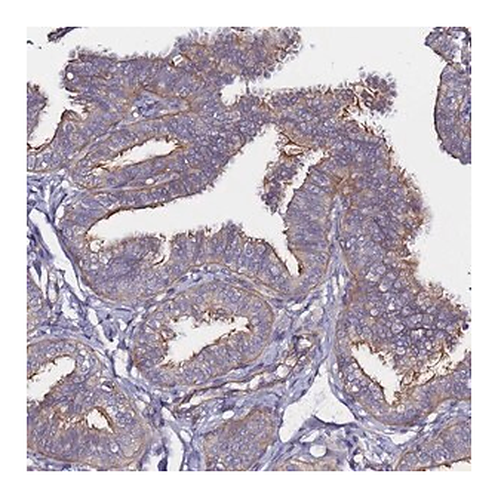 Merck Anti-CCDC13 antibody produced in rabbit