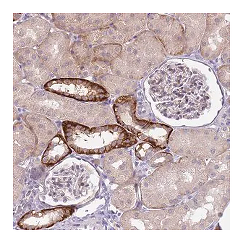 Merck Anti-TRMT10A antibody produced in rabbit