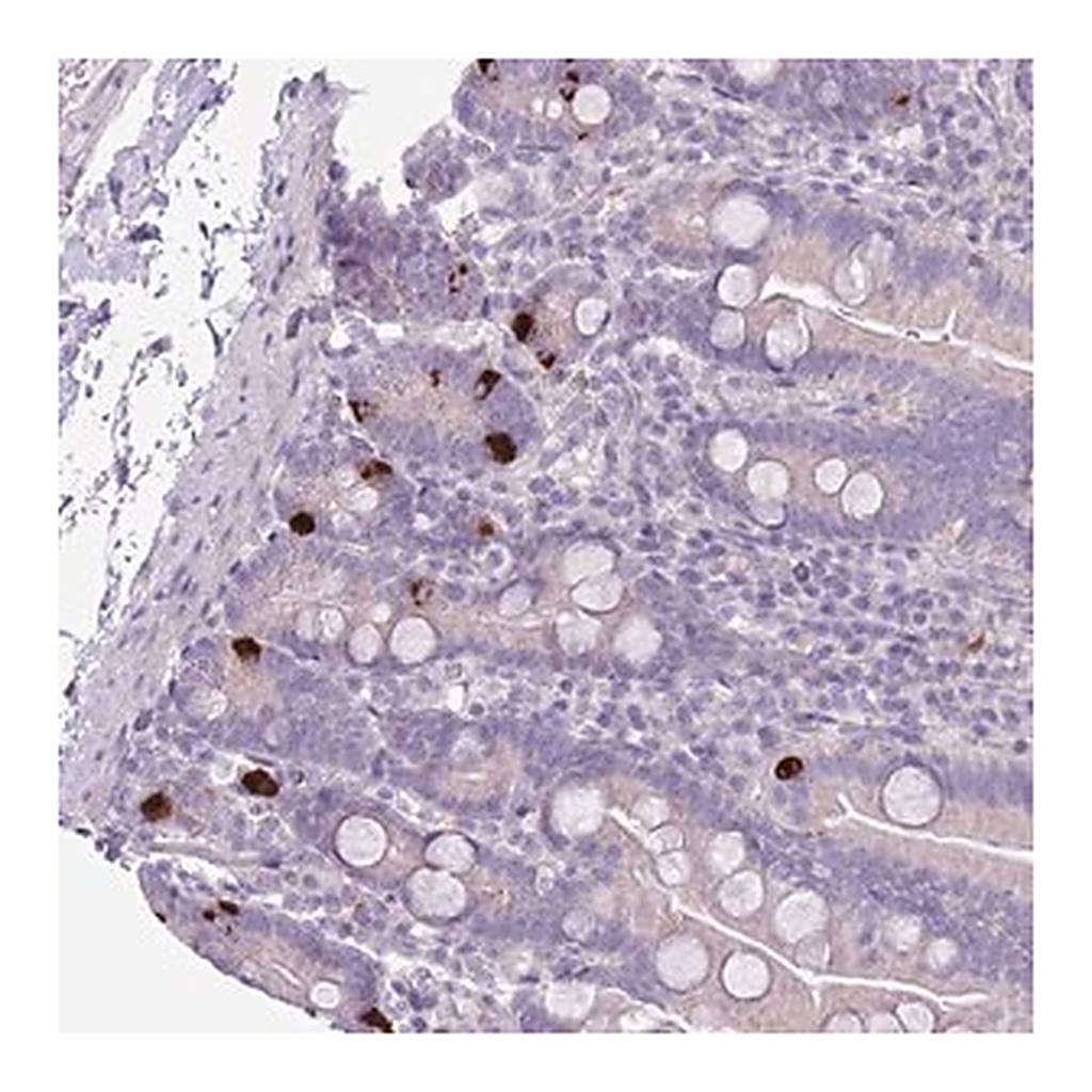 Merck Anti-ZNF697 antibody produced in rabbit