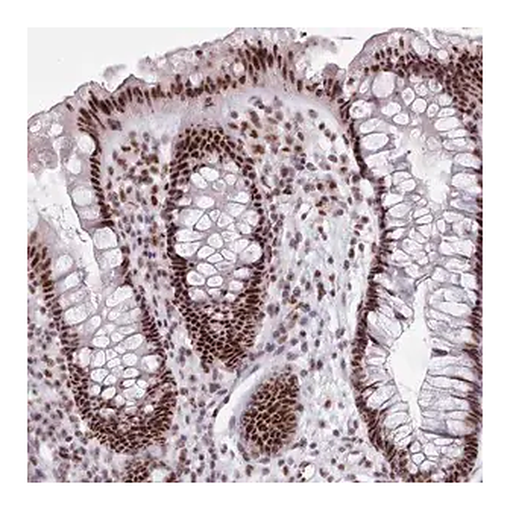 Merck Anti-SRRM1 antibody produced in rabbit