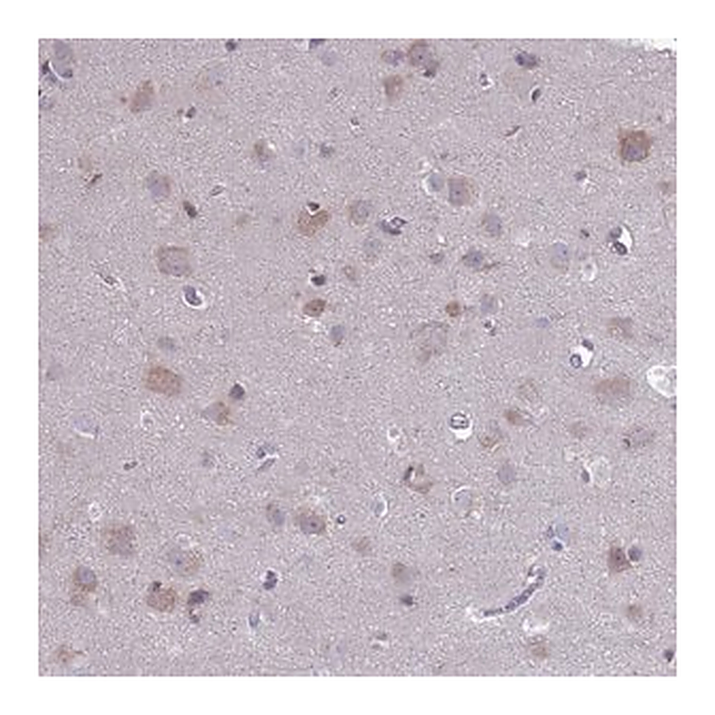 Merck Anti-PET117 antibody produced in rabbit