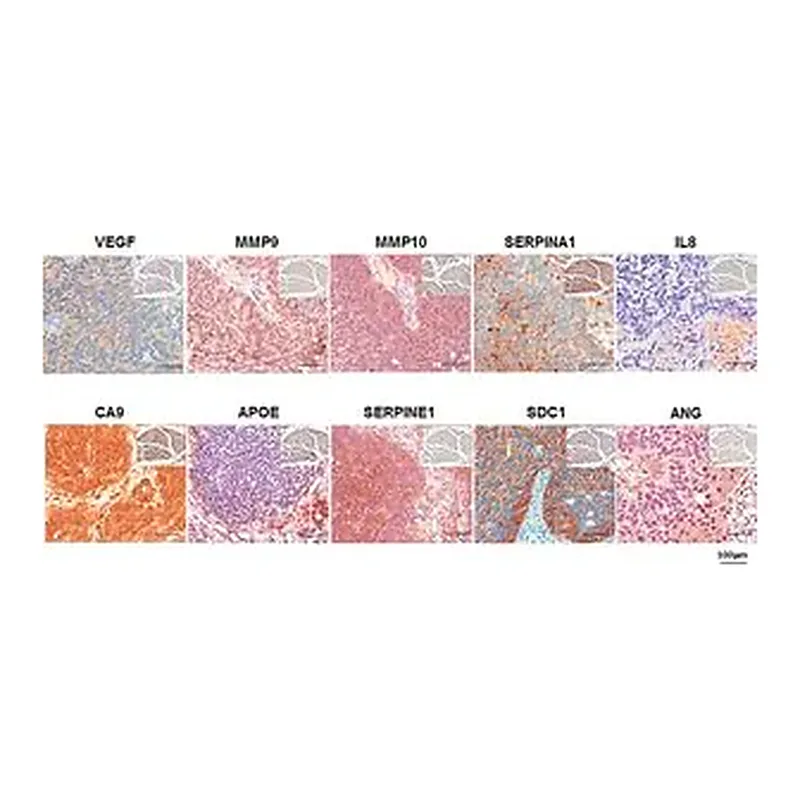 Merck Anti-SERPINE1 antibody produced in rabbit