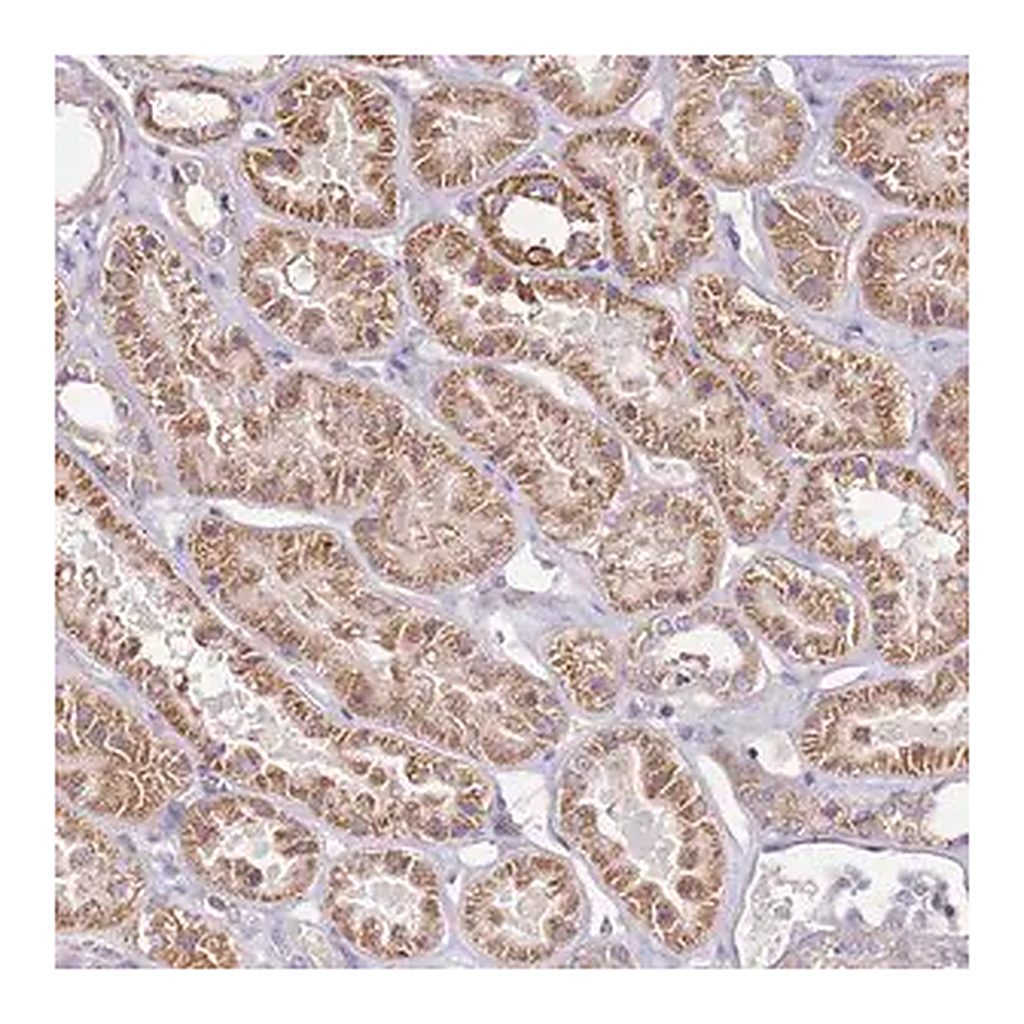 Merck Anti-CMKLR1 antibody produced in rabbit