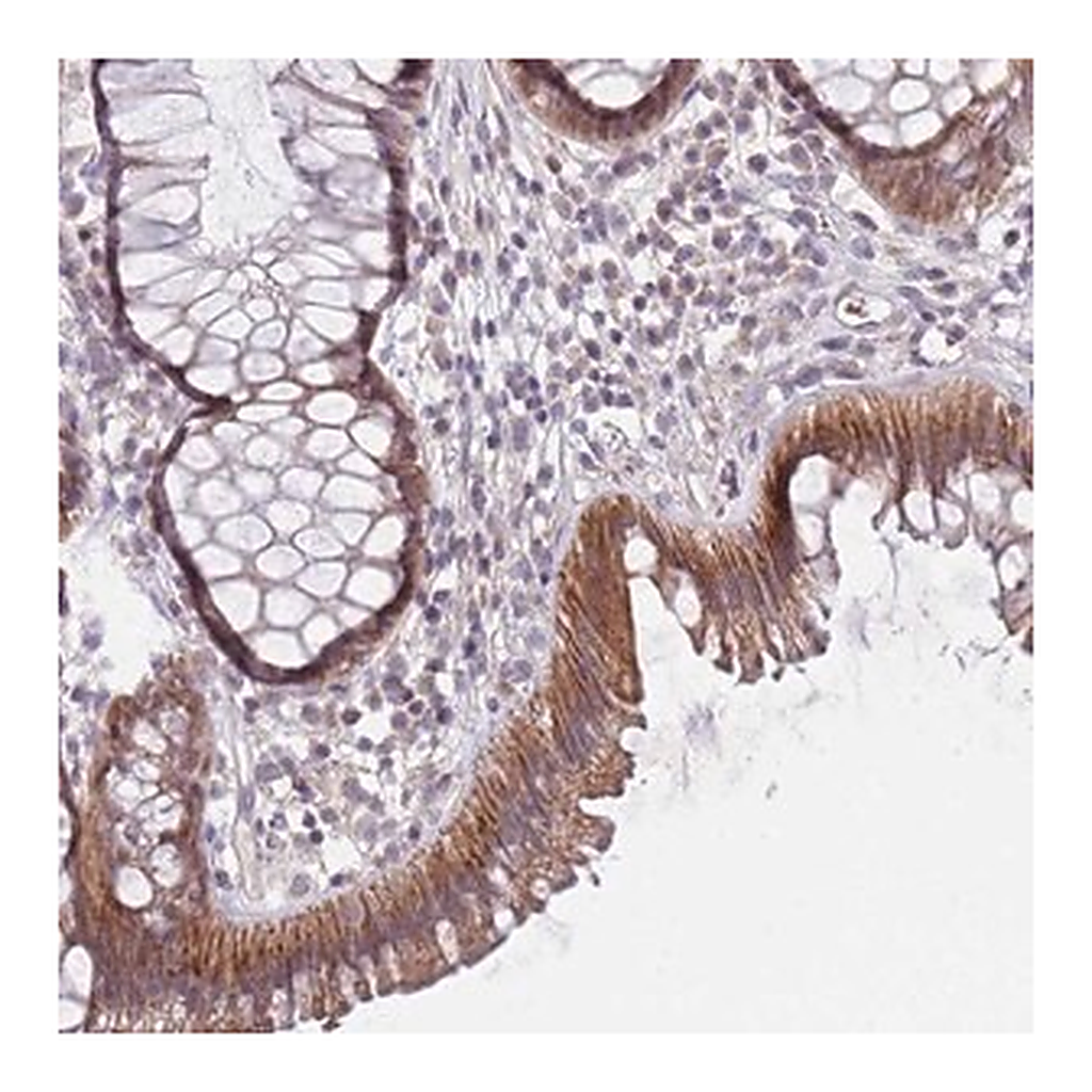 Merck Anti-PRAC1 antibody produced in rabbit